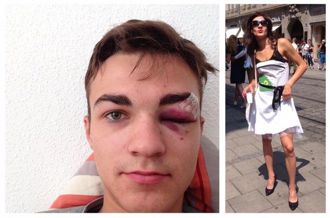 Marcel Rohrlack, Sprecher der Grünen Jugend München, wurde bei einem Angriff nach CSD-Parade verletzt Quelle Foto: Marcel Rohrlack, Facebook